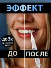 Белый карандаш для отбеливания зубов, отбеливающий карандаш для зубов, гель отбеливающий