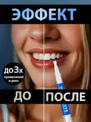 Белый карандаш для отбеливания зубов, отбеливающий карандаш для зубов, гель отбеливающий