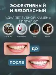 Белый скалер для удаления камня и налета, ультразвуковой