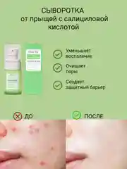 Салатовый эссенция для лица с салициловой кислотой, сыворотка анти-акне, от прыщей