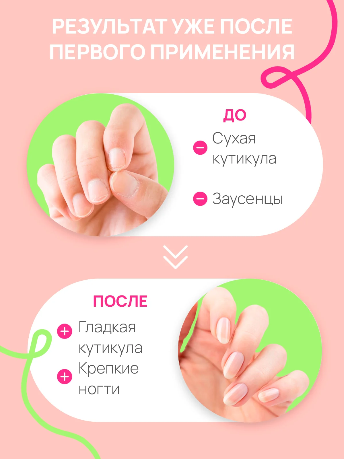 Масло для ногтей и кутикулы USHINE ухаживающее 30 мл