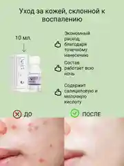 Сыворотка порошок от акне  и прыщейс салициловой кислотой,