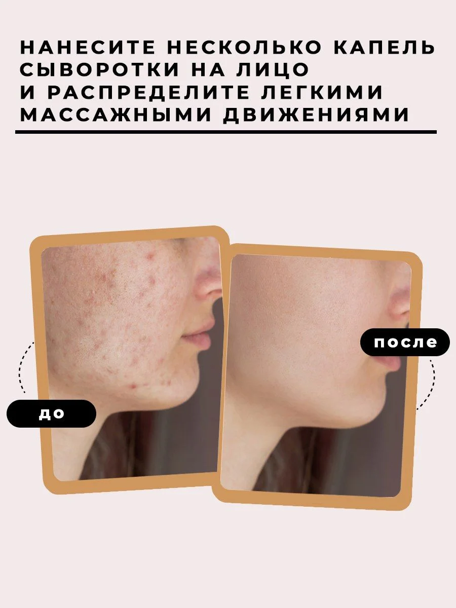 Сыворотка для лица 50 мл, Pravilnaya Kosmetika