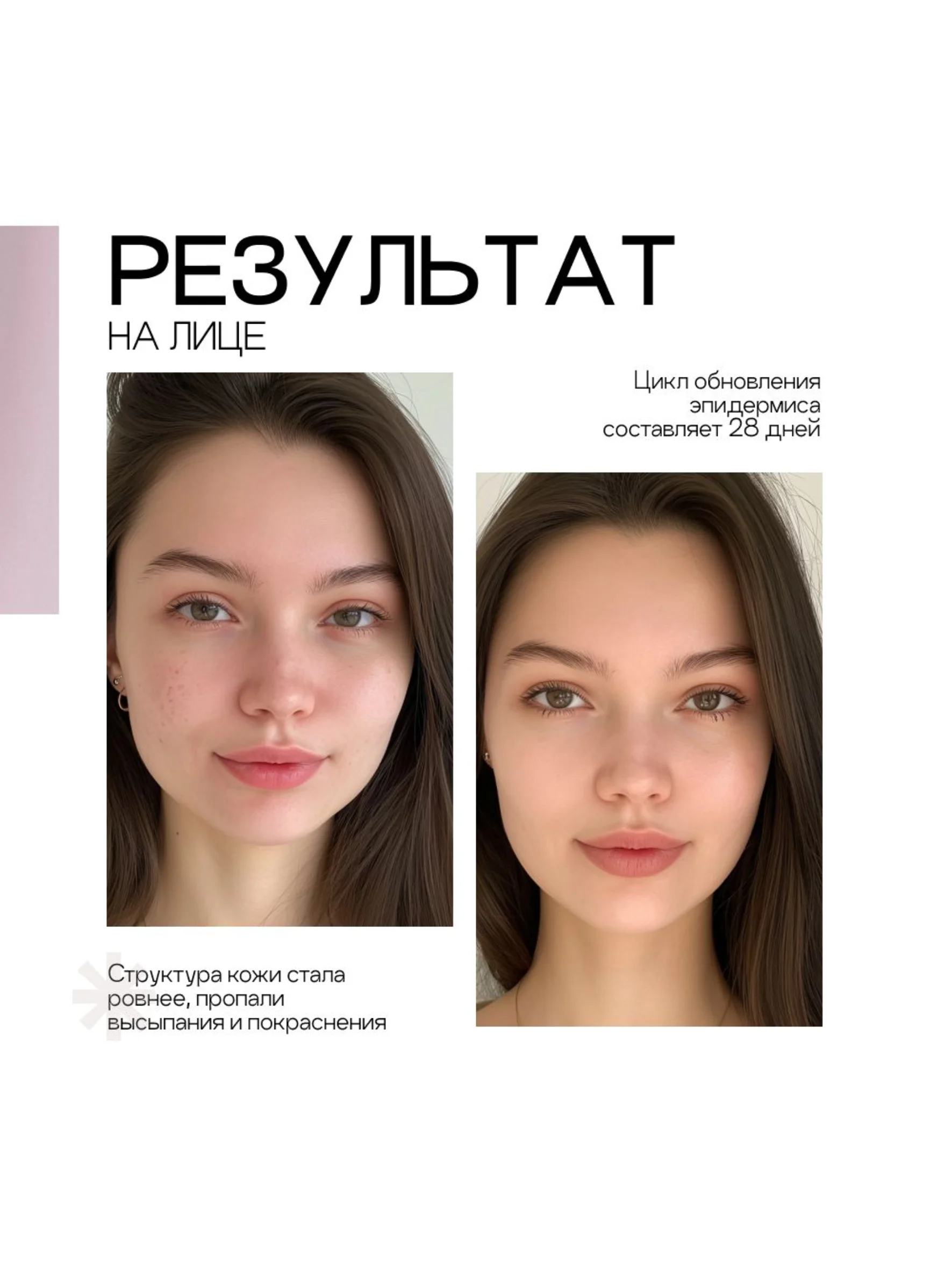 To My Skin / Сыворотка кислотный пилинг для лица 10% AHA и BHA, 30 мл.
