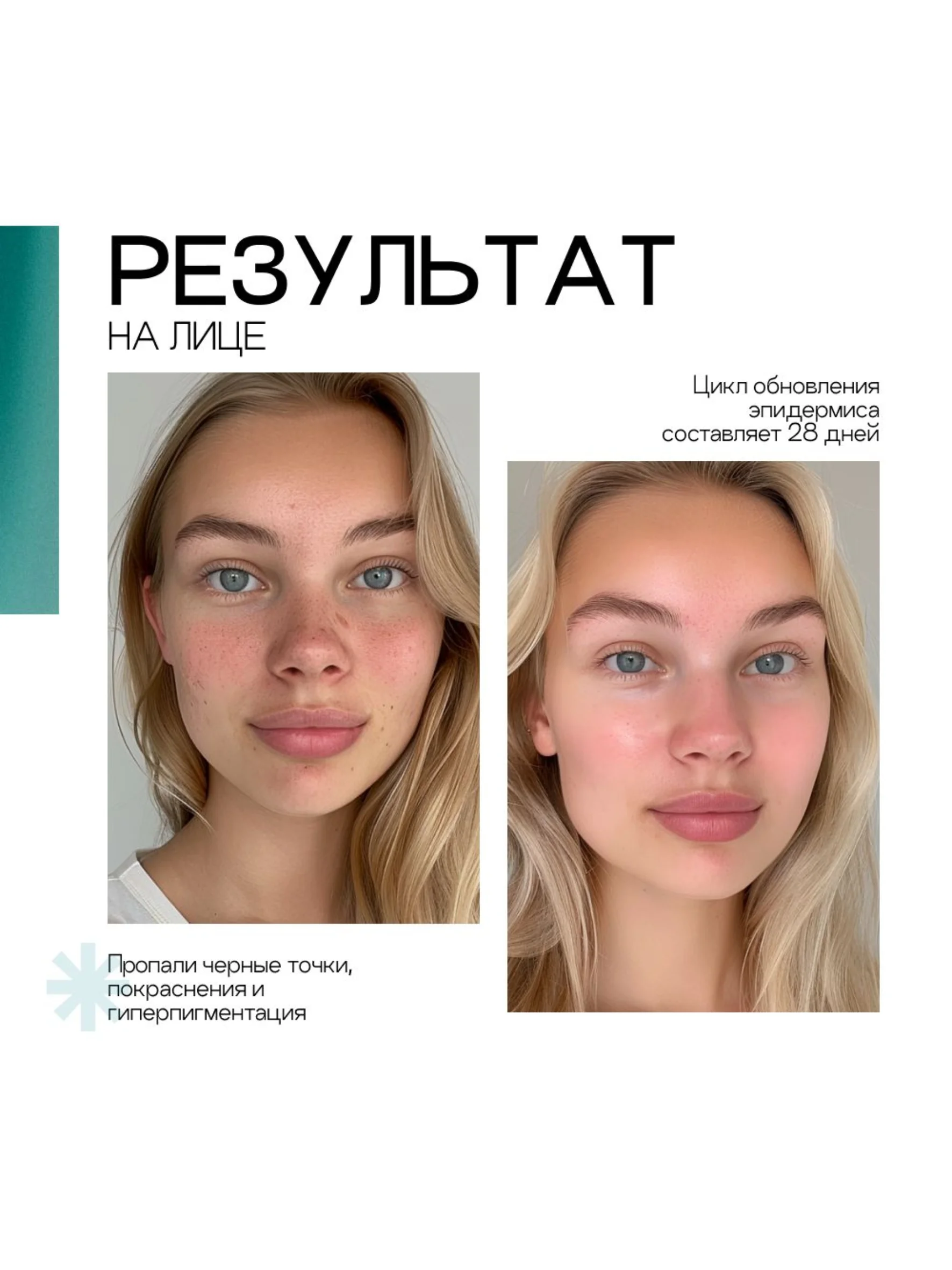 To My Skin / Сыворотка для лица от прыщей центелла и пантенол, 30 мл.
