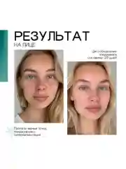 To My Skin / Сыворотка для лица от прыщей центелла и пантенол, 30 мл.
