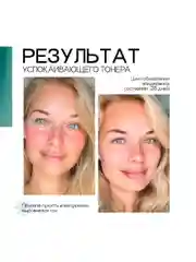 To My Skin / Тонер для лица увлажняющий успокаивающий от прыщей с кислотами, 200 мл
