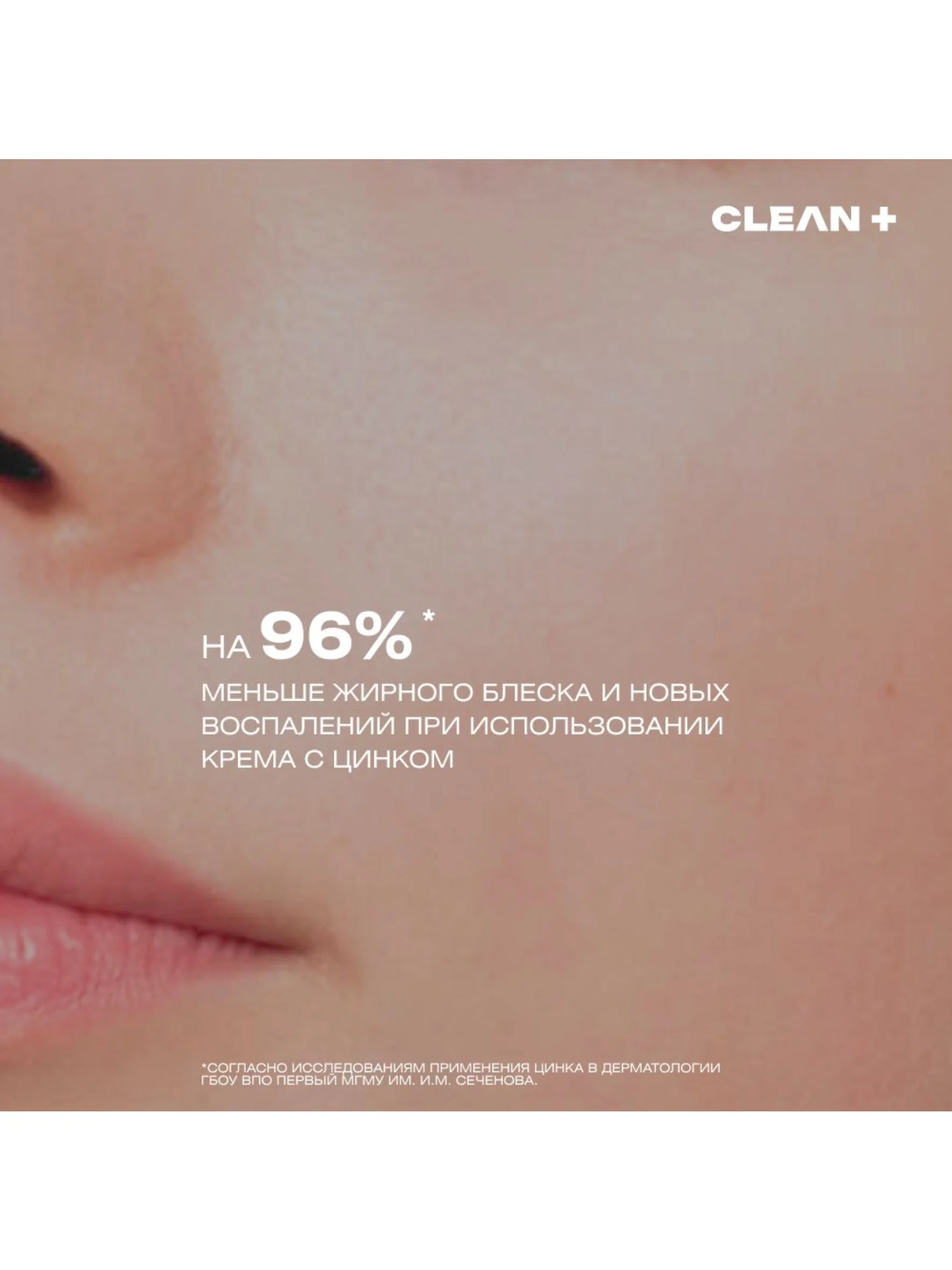CLEAN+ Крем для лица корректирующий против прыщей и постакне ACNE CONTROL, 50 мл