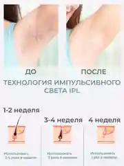 Белый фотоэпилятор лазерный для удаления волос