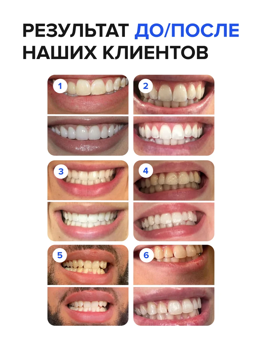 Безопасный отбеливающий карандаш для зубов EMRA