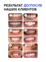 Безопасный отбеливающий карандаш для зубов EMRA