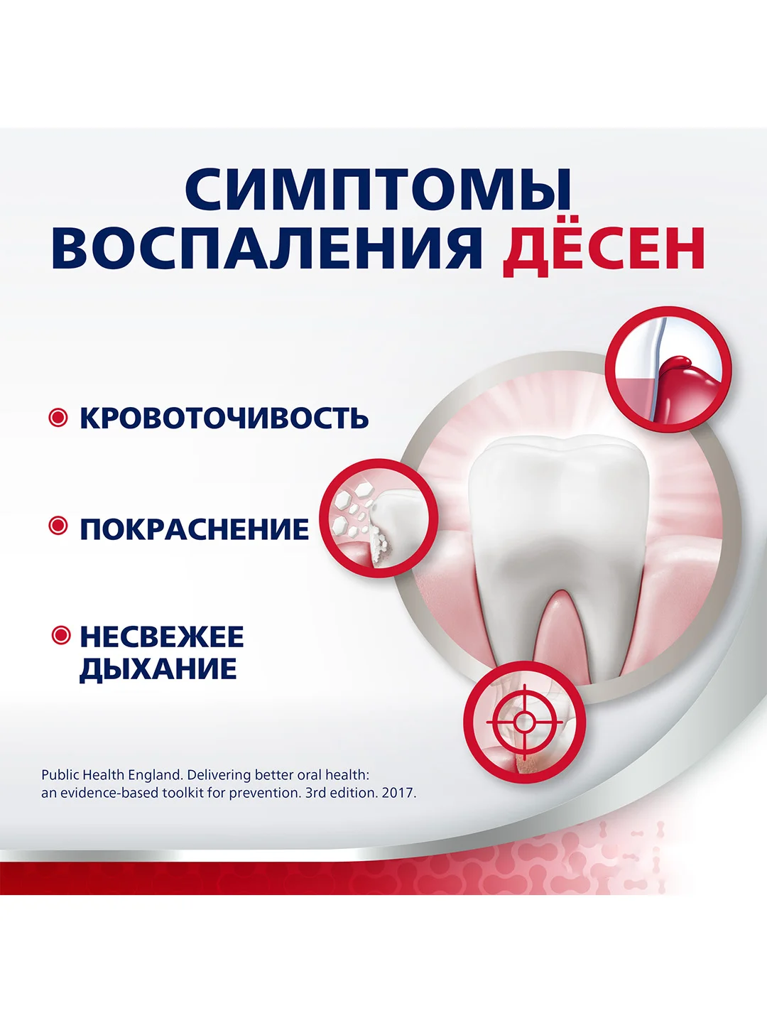 Зубная паста parodontax с Фтором от воспаления и кровоточивости десен, 75 мл