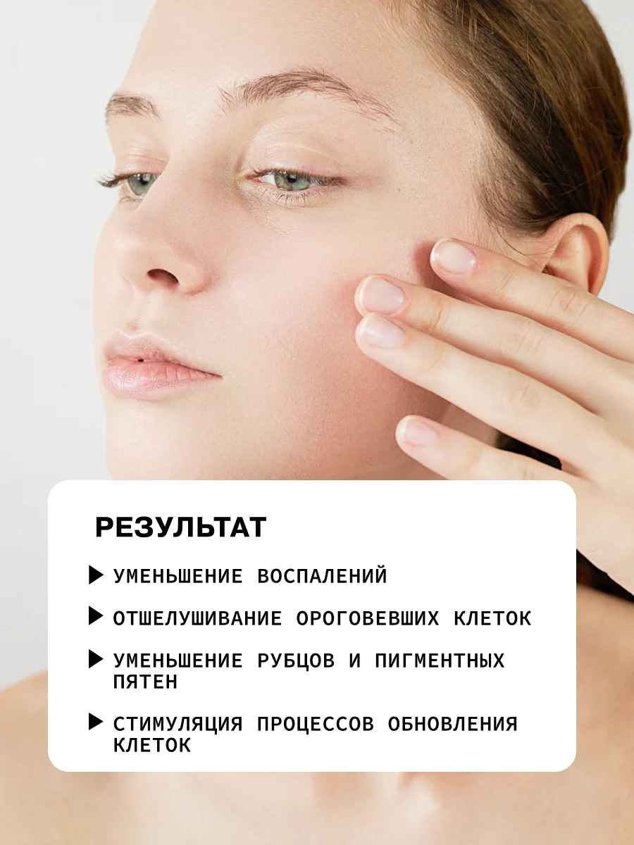 Противовоспалительная анти-акне сыворотка для ухода за кожей лица ART&FACT