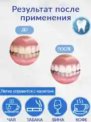 Лазурный отбеливающие полоски для зубов 9D White, 1 пара и 7 пар, полоски отбеливающие