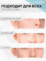 Инструменты для механической чистки лица КАРТОФАН от акне, прыщей, петля с иглой Видаля