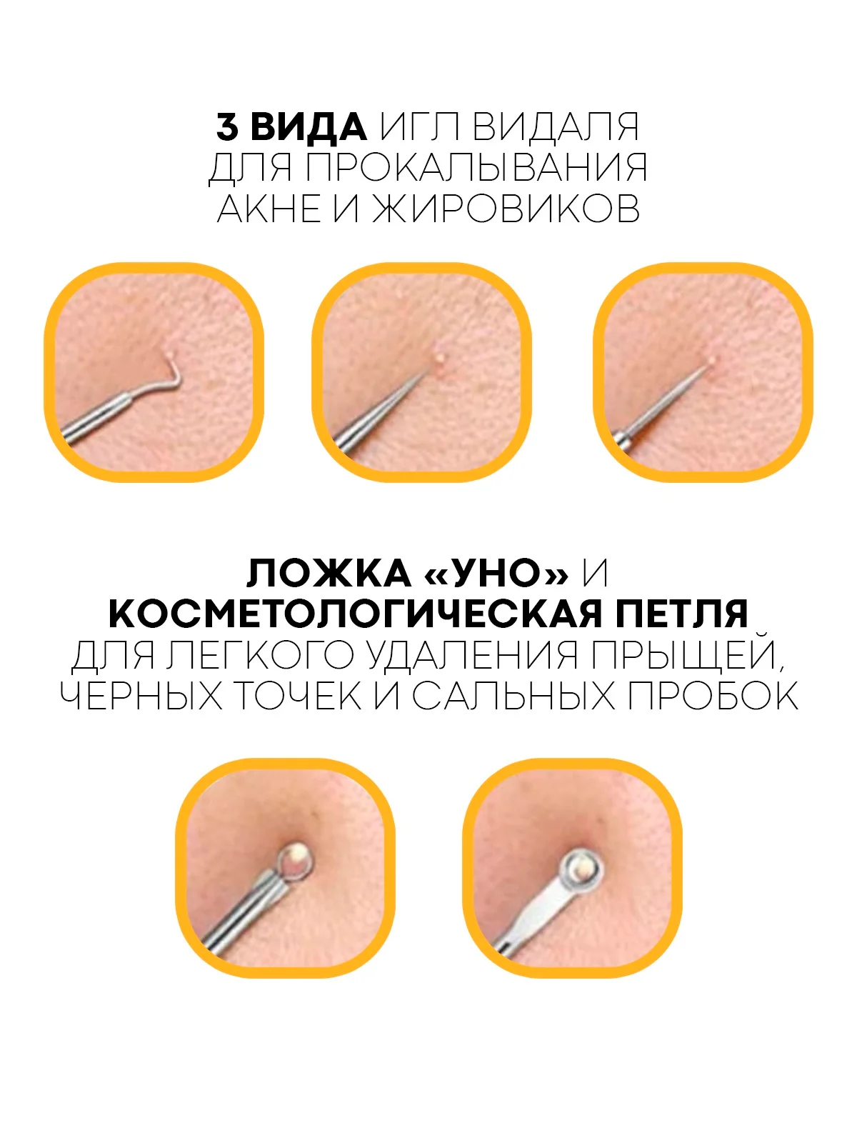 Инструменты для механической чистки лица КАРТОФАН от акне, прыщей, петля с иглой Видаля