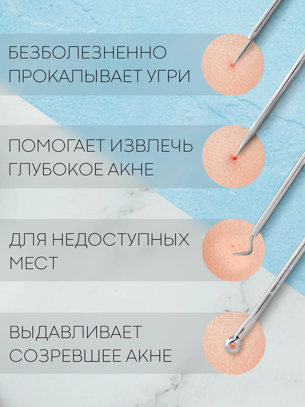 Инструменты для механической чистки лица КАРТОФАН от акне, прыщей, петля с иглой Видаля