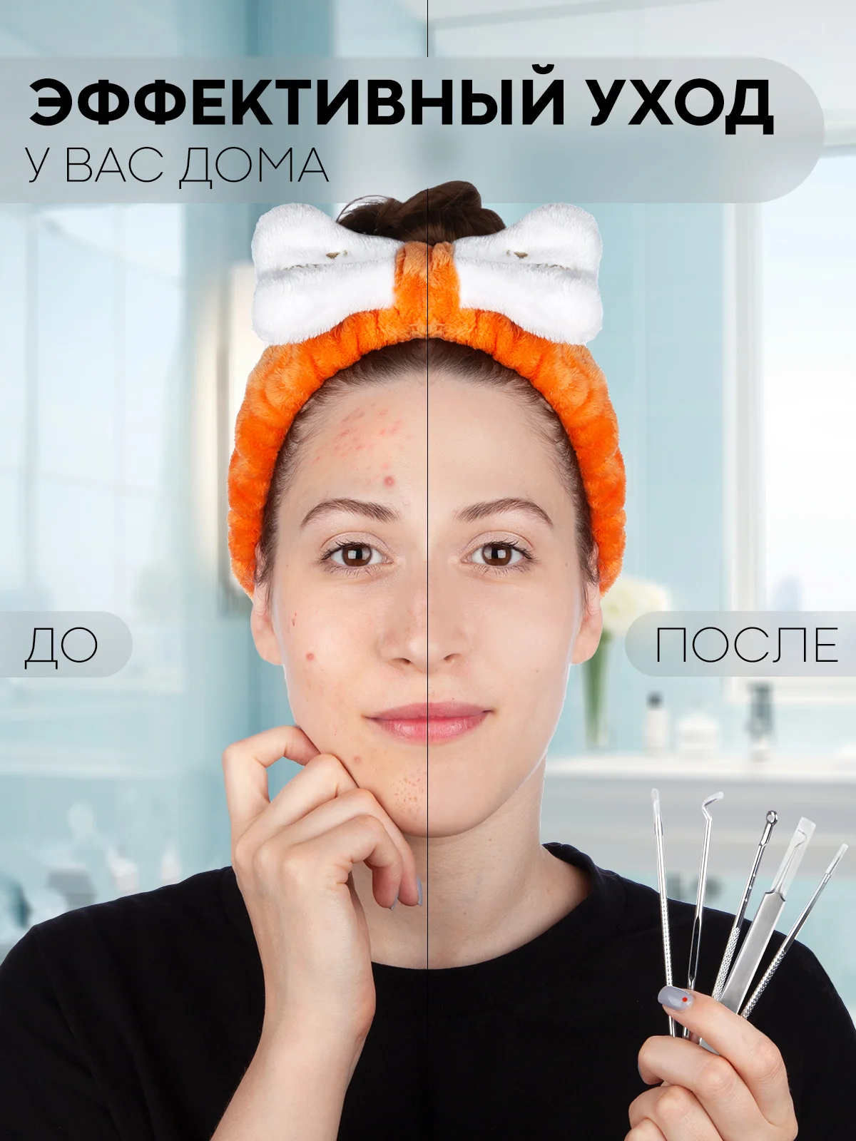 Инструменты для механической чистки лица КАРТОФАН от акне, прыщей, петля с иглой Видаля