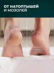 Крем для тела от трещин и шелушений с эвкалиптом, крем для ног, для сухой кожи пяток