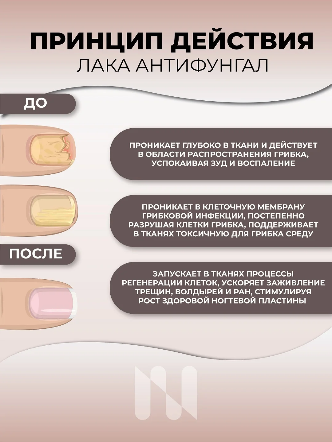 Лак антифунгал Basic камуфлирующий, 11 мл