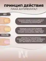 Лак антифунгал Basic камуфлирующий, 11 мл
