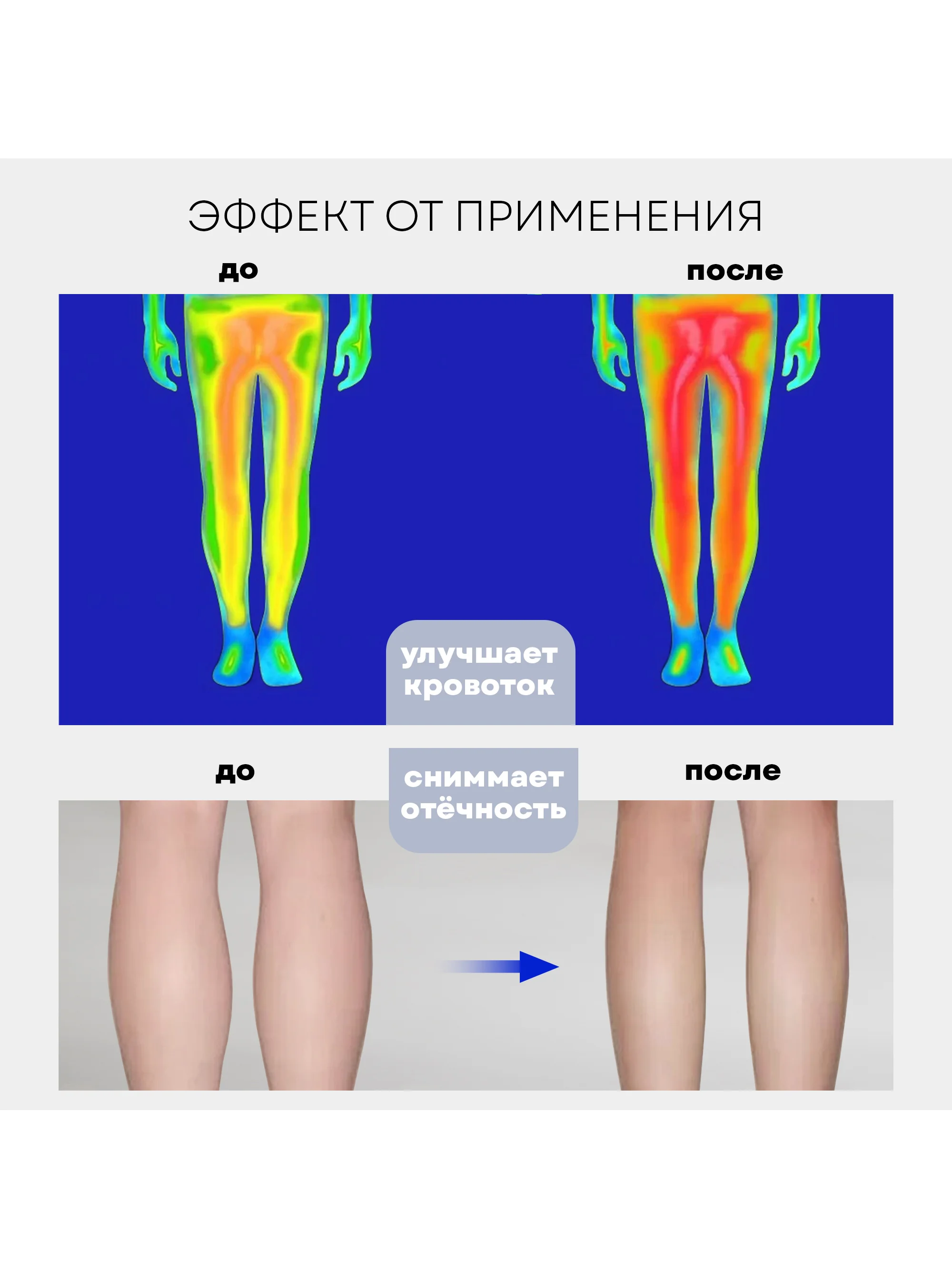 Компрессионный лимфодренажный массажер для ног MFC-40, 3 режима, 3 уровня интенсивности