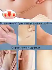 Бежевый пластырь силиконовый от шрамов и рубцов, пластырь профилактический