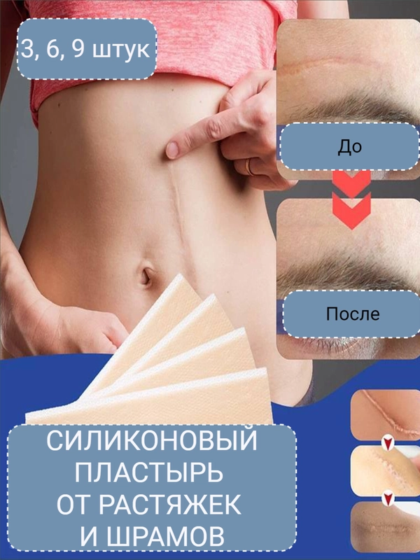 Пластырь силиконовый от шрамов и рубцов, пластырь профилактический