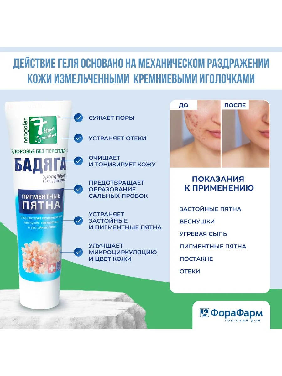 Гель 7 Нот Здоровья  для кожи Бадяга от угревой сыпи и пигментных пятен, 50мл