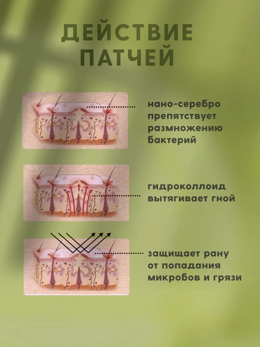 Точечные патчи от прыщей на лице
