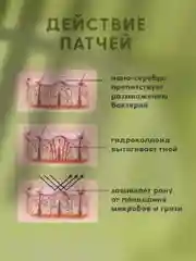 Точечные патчи от прыщей на лице