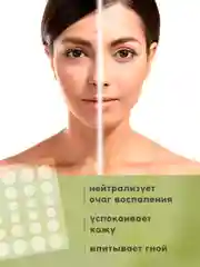 Точечные патчи от прыщей на лице