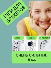 Сильные латексные тяги, резинки для брекетов, эластики, ортодонтические, баран
