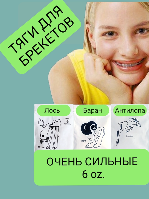 Сильные латексные тяги, резинки для брекетов, эластики, ортодонтические, баран