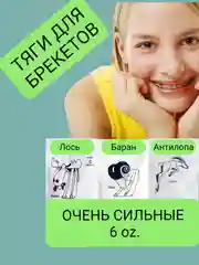 Прозрачный сильные латексные тяги, резинки для брекетов, эластики, ортодонтические, баран