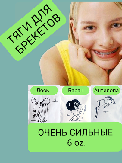 Сильные латексные тяги, резинки для брекетов, эластики, ортодонтические, баран
