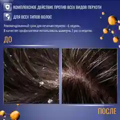 Шампунь от перхоти лечебный очищающий для всех типов волос KRASSA MED 150 мл