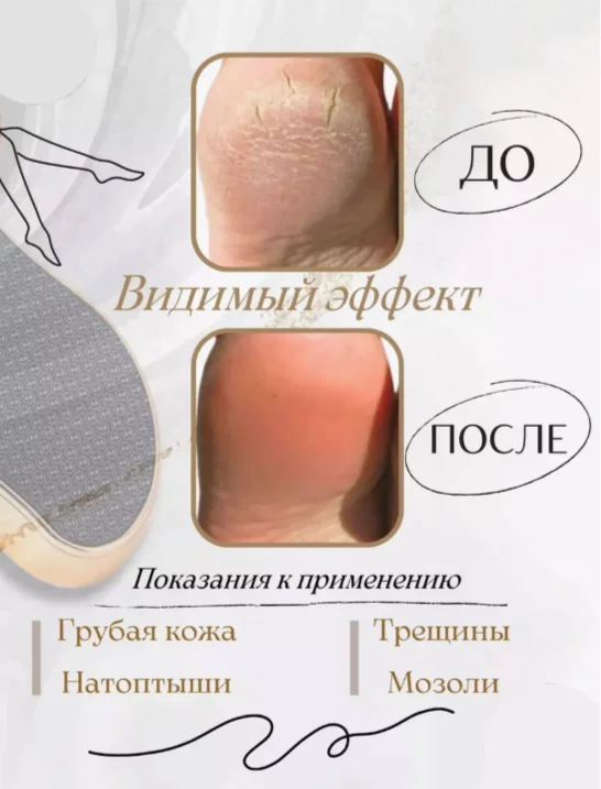 Синий лазерная нано-пилка для ног, пемза для пяток, терка для стоп