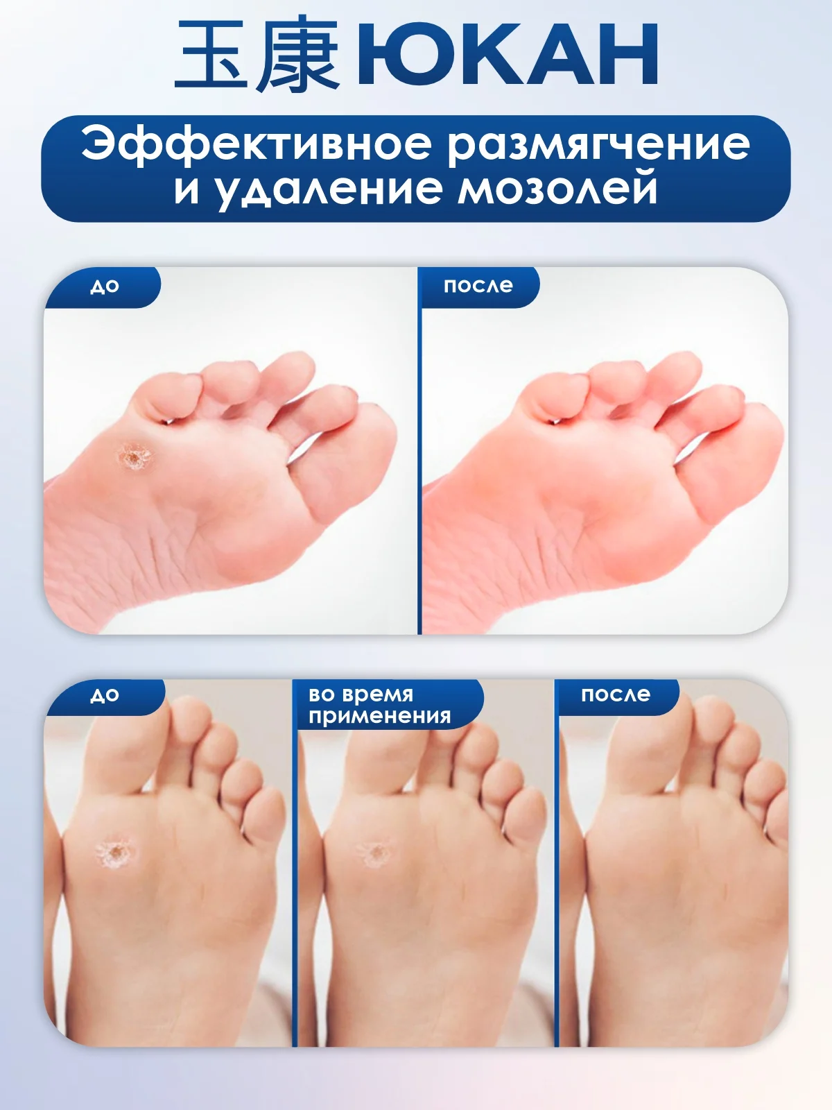 Пластырь от мозолей и натоптышей "Шелковые пяточки", 12 шт