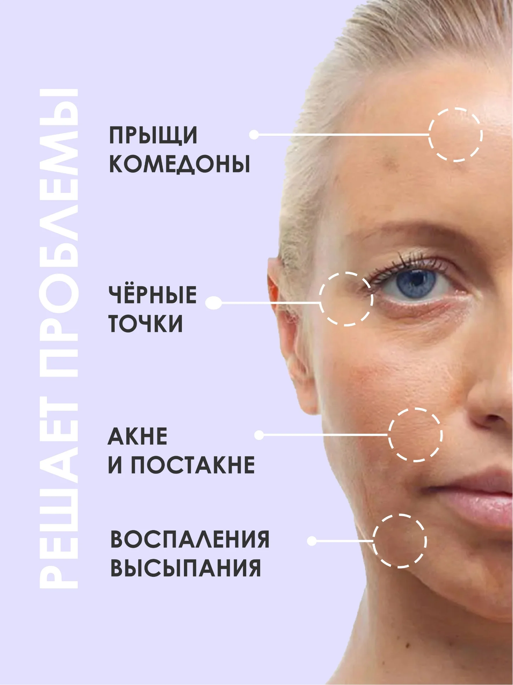 Концентрированная сыворотка для проблемной кожи от прыщей и постакне