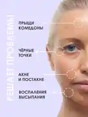 Концентрированная сыворотка для проблемной кожи от прыщей и постакне