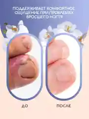 Масло для кутикулы и ногтей, средство от вросшего ногтя Инки
