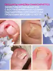 Масло для кутикулы и ногтей, средство от вросшего ногтя Инки