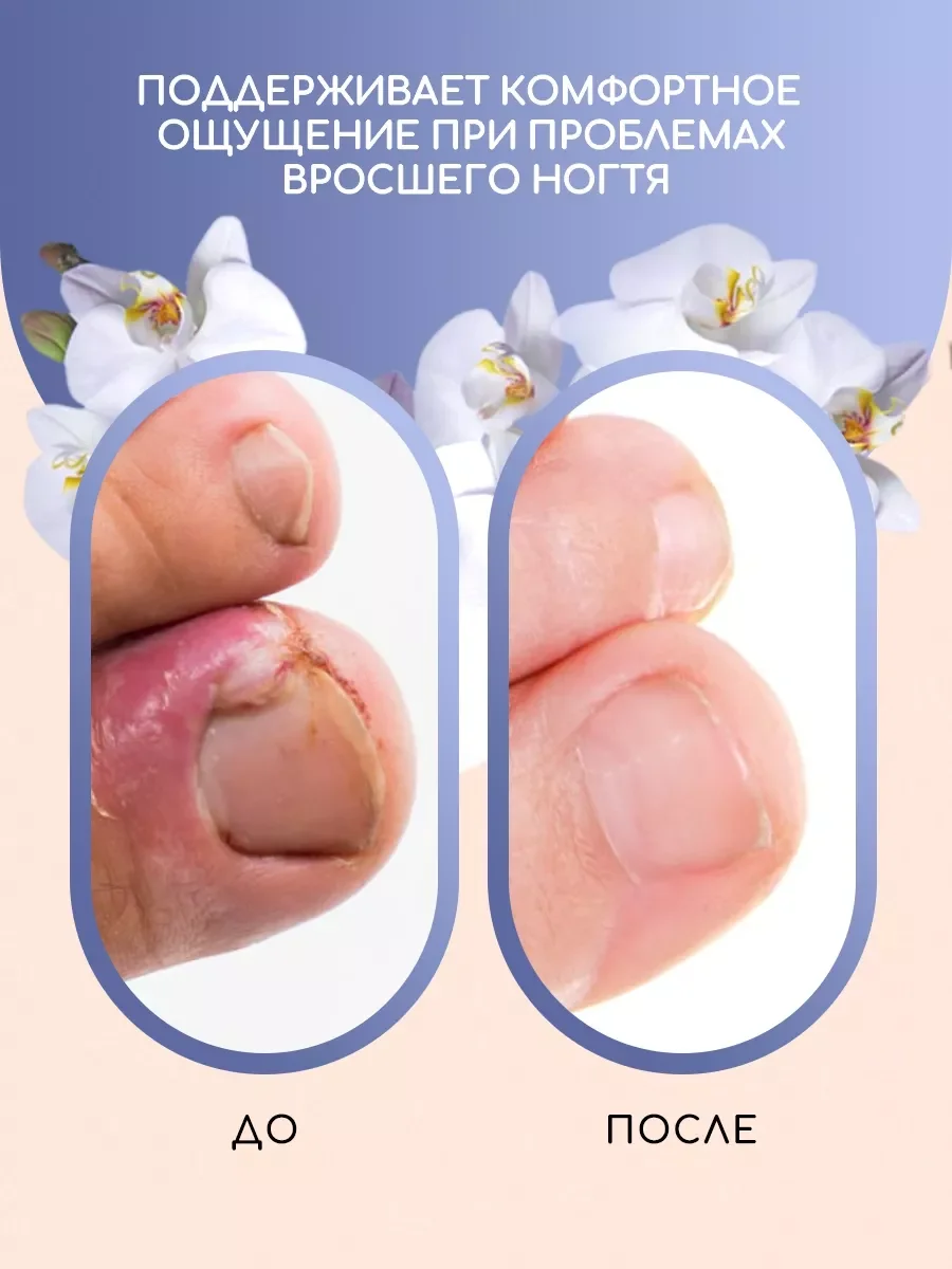 Смягчающий бальзам для кутикулы, воск от вросшего ногтя