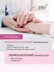 Средство от грибка ногтей, бальзам "Стоп онихолизис"