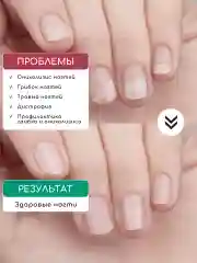 Средство от грибка ногтей, бальзам "Стоп онихолизис"