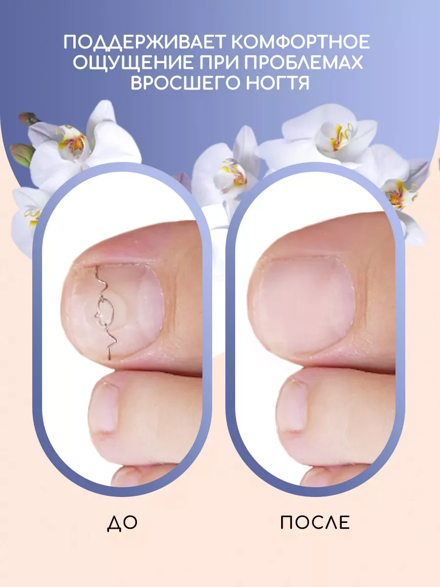 Сыворотка для ногтей и кутикулы, средство от вросшего ногтя