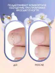 Сыворотка для ногтей и кутикулы, средство от вросшего ногтя