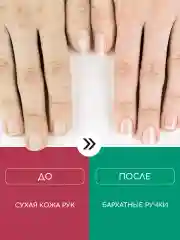 Набор кремов для сухой кожи рук и ног от трещин с мочевиной