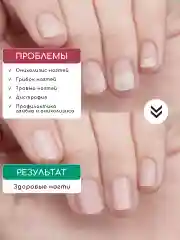 Набор "Стоп онихолизис": Лосьон 1 и 2 и бальзам, 10 мл, от грибка